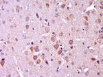 CTNNBIP1 Antibody in Immunohistochemistry (Paraffin) (IHC (P))