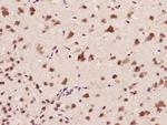 CARM1 Antibody in Immunohistochemistry (Paraffin) (IHC (P))