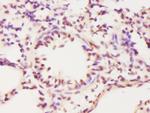 ECT2 Antibody in Immunohistochemistry (Paraffin) (IHC (P))