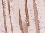 Myoglobin Antibody in Immunohistochemistry (Paraffin) (IHC (P))