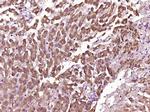 Myoglobin Antibody in Immunohistochemistry (Paraffin) (IHC (P))