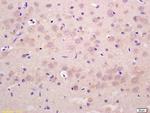 GIT1 Antibody in Immunohistochemistry (Paraffin) (IHC (P))