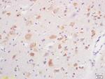 GABA A Receptor gamma 2 Antibody in Immunohistochemistry (Paraffin) (IHC (P))