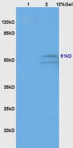 GABA A Receptor gamma 2 Antibody in Western Blot (WB)