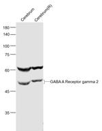 GABA A Receptor gamma 2 Antibody in Western Blot (WB)