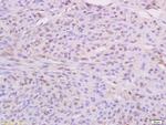 IKBKE Antibody in Immunohistochemistry (Paraffin) (IHC (P))