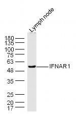 IFNAR1 Antibody in Western Blot (WB)