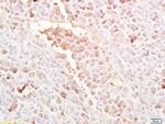 LRP5 Antibody in Immunohistochemistry (Paraffin) (IHC (P))