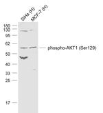 TNMD Antibody in Western Blot (WB)