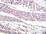 PAP2B Antibody in Immunohistochemistry (Paraffin) (IHC (P))