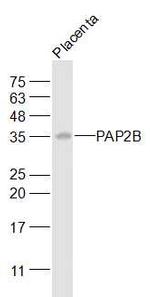 PAP2B Antibody in Western Blot (WB)