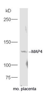 MAP4 Antibody in Western Blot (WB)