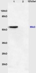 IKB epsilon Antibody in Western Blot (WB)