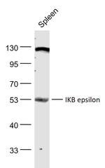 IKB epsilon Antibody in Western Blot (WB)