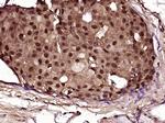 NF1 Antibody in Immunohistochemistry (Paraffin) (IHC (P))