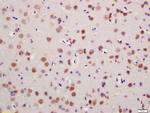 Glutamine synthetase Antibody in Immunohistochemistry (Paraffin) (IHC (P))