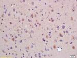 SYTL5 Antibody in Immunohistochemistry (Paraffin) (IHC (P))
