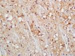 PLCL1 Antibody in Immunohistochemistry (Paraffin) (IHC (P))