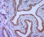 PKC theta Antibody in Immunohistochemistry (Paraffin) (IHC (P))