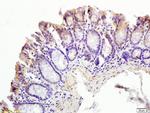 CT054 Antibody in Immunohistochemistry (Paraffin) (IHC (P))