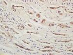 YES1 Antibody in Immunohistochemistry (Paraffin) (IHC (P))