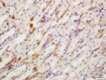 YES1 Antibody in Immunohistochemistry (Paraffin) (IHC (P))