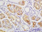 YES1 Antibody in Immunohistochemistry (Paraffin) (IHC (P))