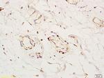 Angiomotin Antibody in Immunohistochemistry (Paraffin) (IHC (P))