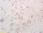 Synaptotagmin Antibody in Immunohistochemistry (Paraffin) (IHC (P))