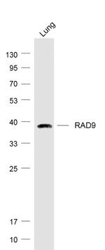 RAD9 Antibody in Western Blot (WB)