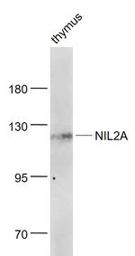 ZEB1/2 Antibody in Western Blot (WB)