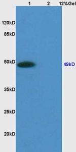 Sphingomyelin Synthase 1 Antibody in Western Blot (WB)