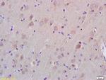 ZDHHC21 Antibody in Immunohistochemistry (Paraffin) (IHC (P))