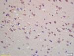 ADORA1 Antibody in Immunohistochemistry (Paraffin) (IHC (P))