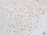 LONP1 Antibody in Immunohistochemistry (Paraffin) (IHC (P))