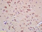 CHRNB Antibody in Immunohistochemistry (Paraffin) (IHC (P))