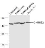 CHRNB Antibody in Western Blot (WB)