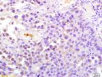 ATP1A1 Antibody in Immunohistochemistry (Paraffin) (IHC (P))