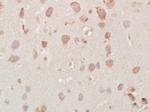 Vesicle docking protein p115 Antibody in Immunohistochemistry (Paraffin) (IHC (P))