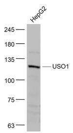 Vesicle docking protein p115 Antibody in Western Blot (WB)