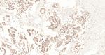 XPB Antibody in Immunohistochemistry (Paraffin) (IHC (P))