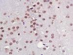 TPX2 Antibody in Immunohistochemistry (Paraffin) (IHC (P))