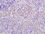 MACC1 Antibody in Immunohistochemistry (Paraffin) (IHC (P))