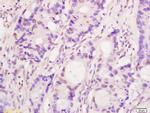 Bub1 Antibody in Immunohistochemistry (Paraffin) (IHC (P))