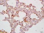 CDC40 Antibody in Immunohistochemistry (Paraffin) (IHC (P))