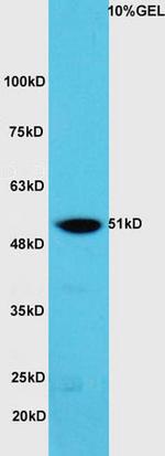 hnRNP K Antibody in Western Blot (WB)