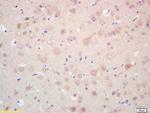 MAP 1A/1B LC3 Alpha/Beta Antibody in Immunohistochemistry (Paraffin) (IHC (P))