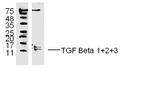 TGF Beta 1+2+3 Antibody in Western Blot (WB)