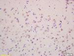 VEGF-A Antibody in Immunohistochemistry (Paraffin) (IHC (P))