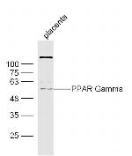 PPAR Gamma Antibody in Western Blot (WB)